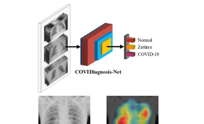 Korona virüs teşhisini kolaylaştıracak yapay zeka sistemi
