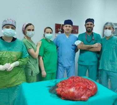 Trabzon’da ameliyata alınan hastanın karnından 21 kiloluk tümör çıkartıldı