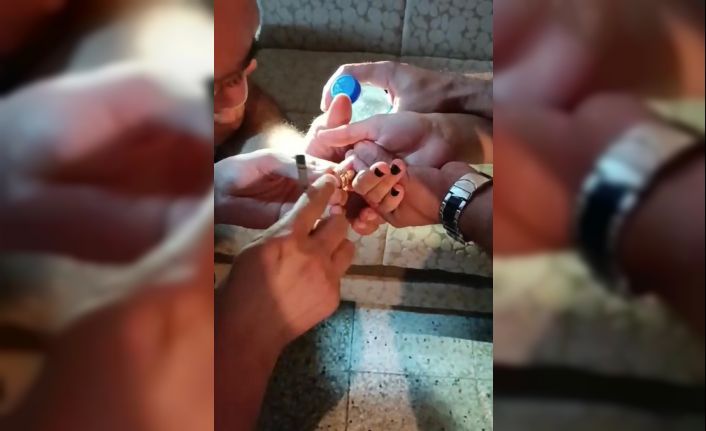 Parmağına yüzük sıkışınca itfaiye ekipleri yardımına yetişti