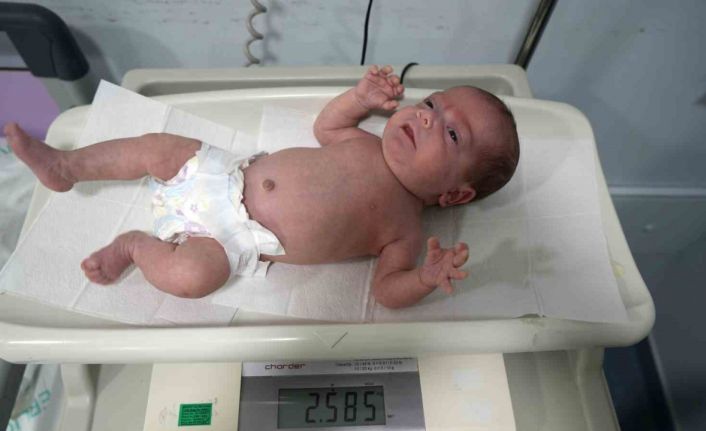 895 gram doğan Güneş bebek hayata tutundu