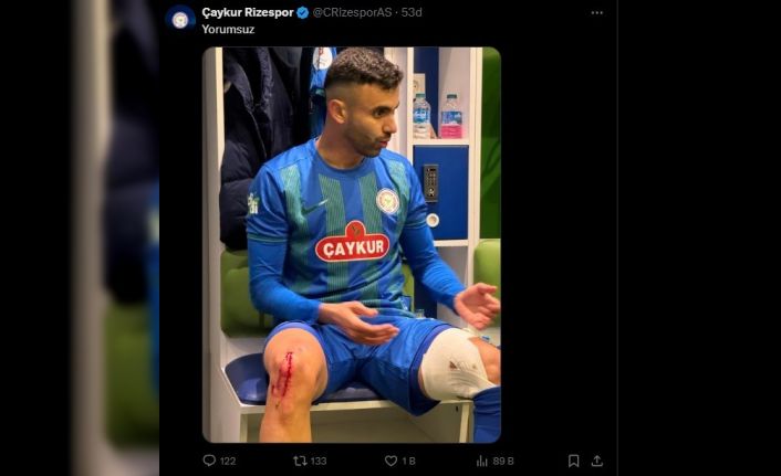 Çaykur Rizespor, Rachid Ghezzal’ın darbe alan ayağının fotoğrafını paylaştı