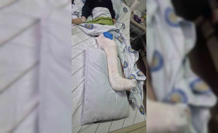 Diyarbakır’da köpeklerden kaçan çocuğun bacağı kırıldı