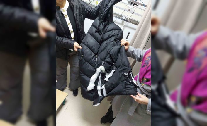 Köpeklerin saldırısına uğrayan kadın yaralandı: O anlar kameraya yansıdı