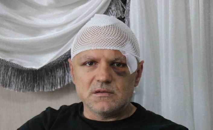 Öldüresiye darp edilen tekel bayii işletmecisi yaşadığı dehşeti anlattı