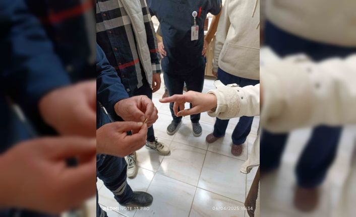 Parmağında yüzük sıkışan vatandaşın yardımına itfaiye koştu
